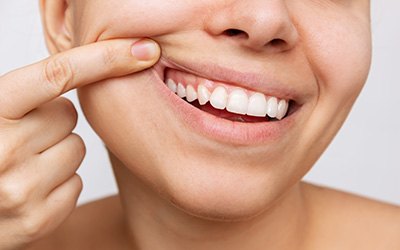 Woman pulling back her lip to show healthy gum tissue