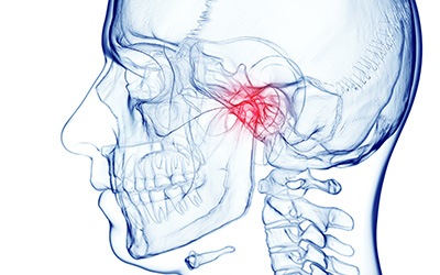 Illustration of human skull showing TMJ joint