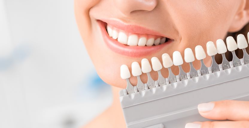 A woman holding a tooth shade chart up to her teeth.